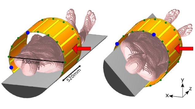 辐射透明身体线圈的 3D 模型